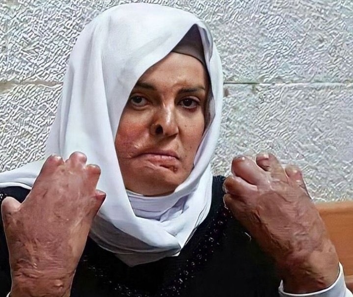 هيئة شؤون الأسرى تحذر من خطورة وضع الأسيرة إسراء الجعابيص