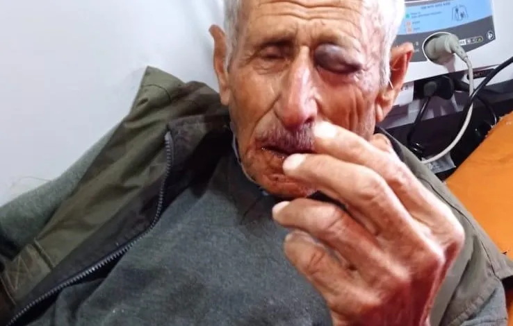مستوطنون يهاجمون مزارعًا وعائلته في كفر الديك غرب سلفيت