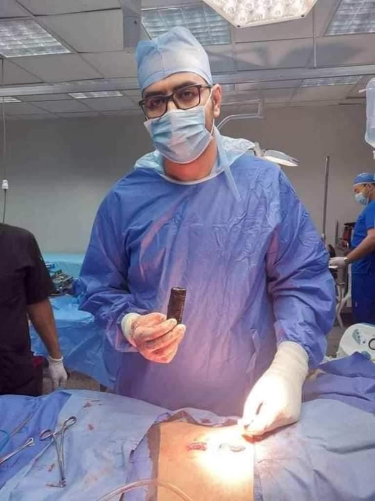 الحالة الثانية.. استخراج هاتف من بطن شاب في مصر