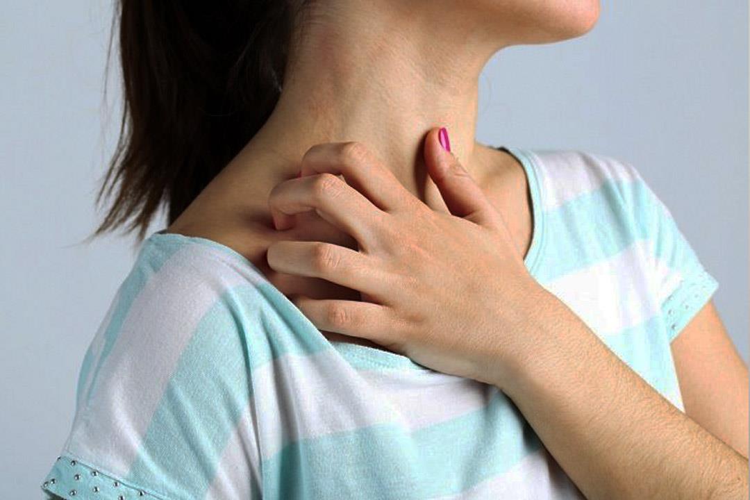 أسباب حكة الجسم الشديدة وعلاج كل منها
