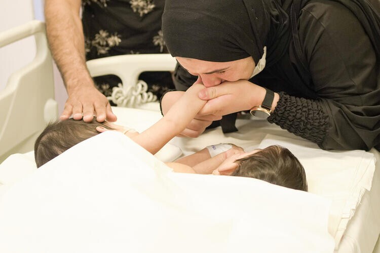 تركيا: نجاح فصل توأمين سياميين بعملية استغرقت 9 ساعات