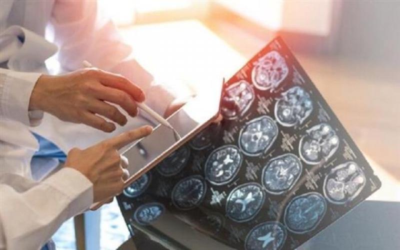 باستخدام الأدوية المشعة.. دواء جديد لمكافحة السرطان في مراحله الأخيرة