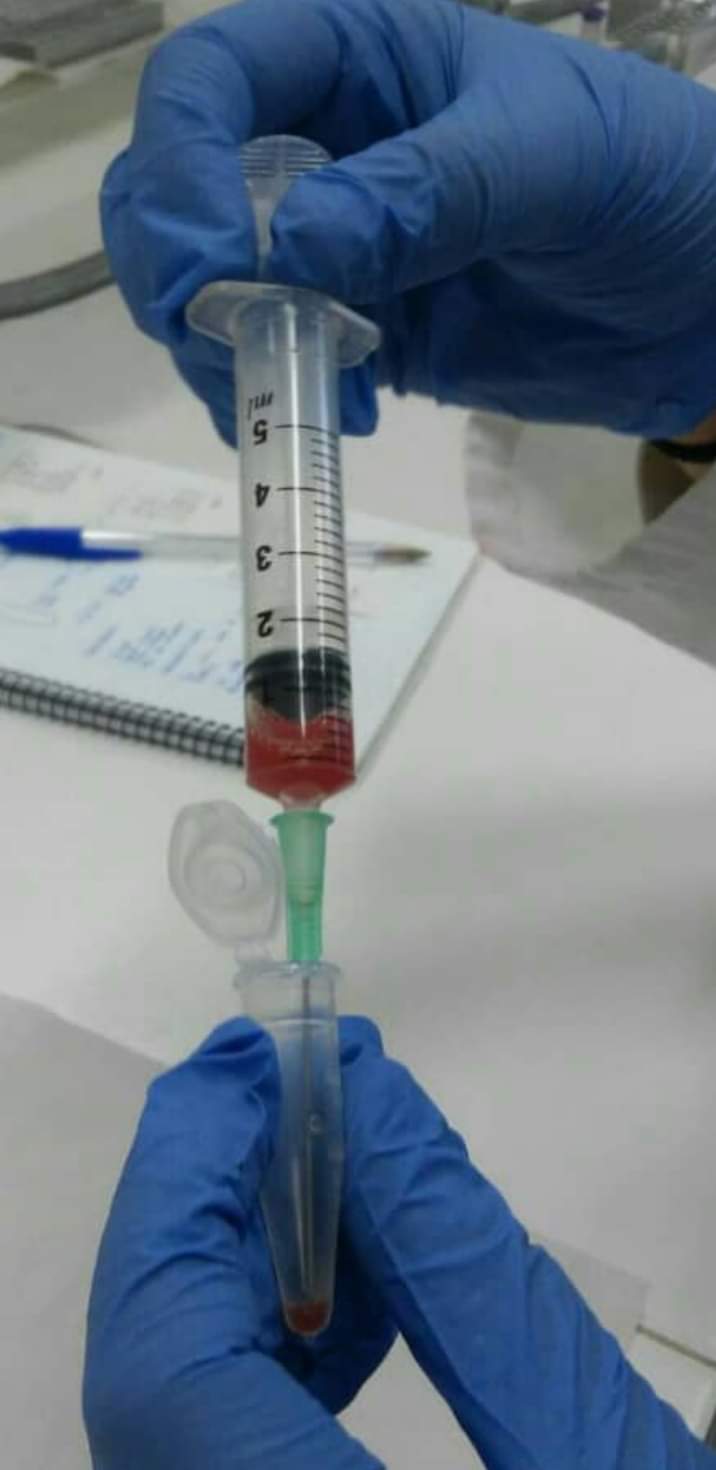 علاج طيف التوحد