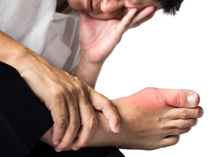 دراسات تربط نوبات داء الملوك بعصير الفاكهة