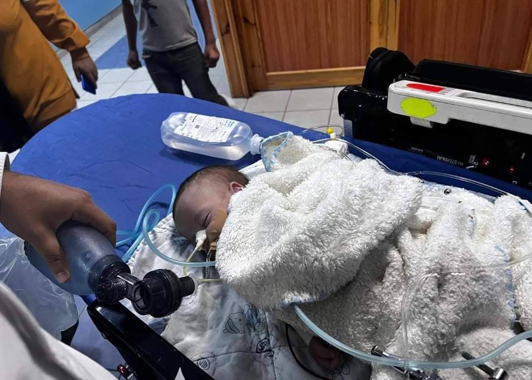استشهاد رضيع عقب اختناقه بغاز مسيل للدموع بالقدس