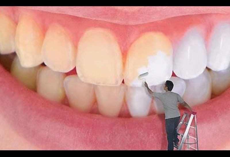 أبرز أسباب اصفرار الأسنان وتغير لونها