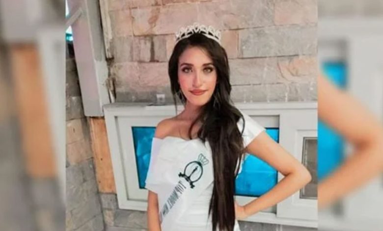 بـ25 غرزة.. تشويه وجه ملكة الجمال  المصرية مروة عادل على يد جارها