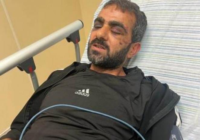 هيئة الأسرى: ما حدث مع الأسير المحرر محمد زهران جريمة قتل
