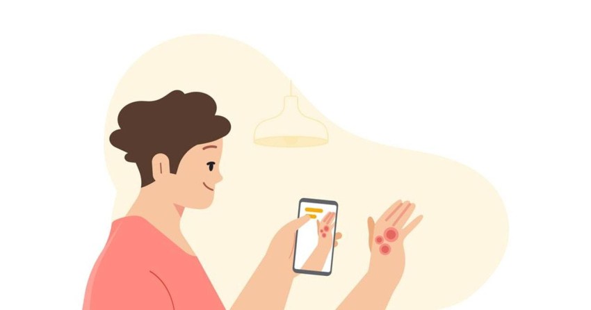 قريباً.. غوغل تطرح أداة تكشف الأمراض الجلدية من خلال الصور