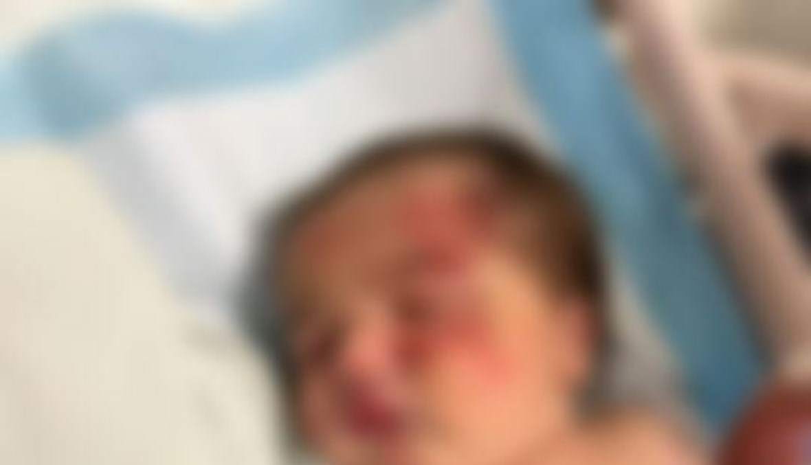حادثة مروعة بلبنان.. كلب يجر كيساً بداخله رضيعة في طرابلس
