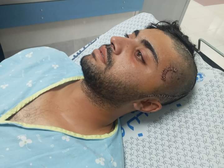 الاحتلال يفرج عن الصياد المصاب نافذ صلاح بعد أيام من اعتقاله