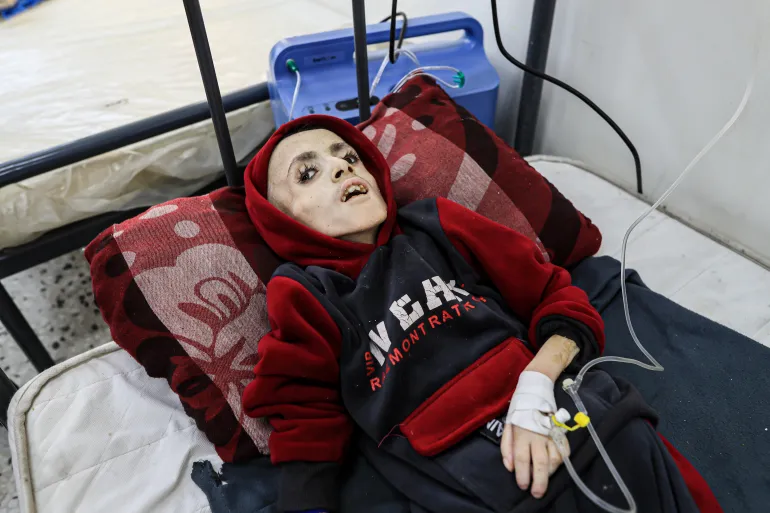 لجنة أممية تحذر من وفاة طفل جديد جوعاً كل دقيقة في غزة