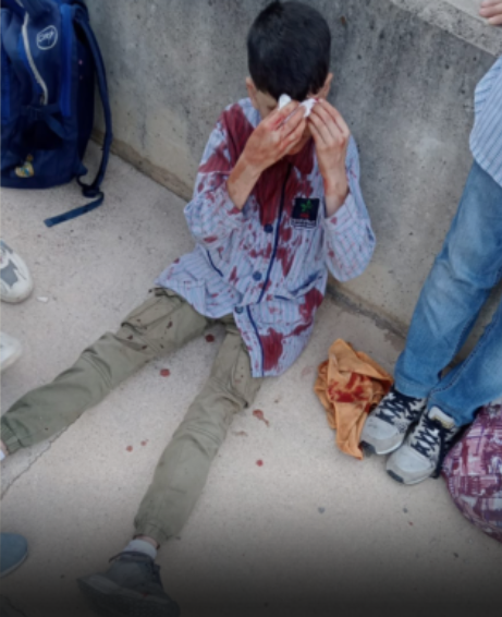 استشهاد سائق وجرح 3 طلبة في قصف إسرائيلي على جنوب لبنان