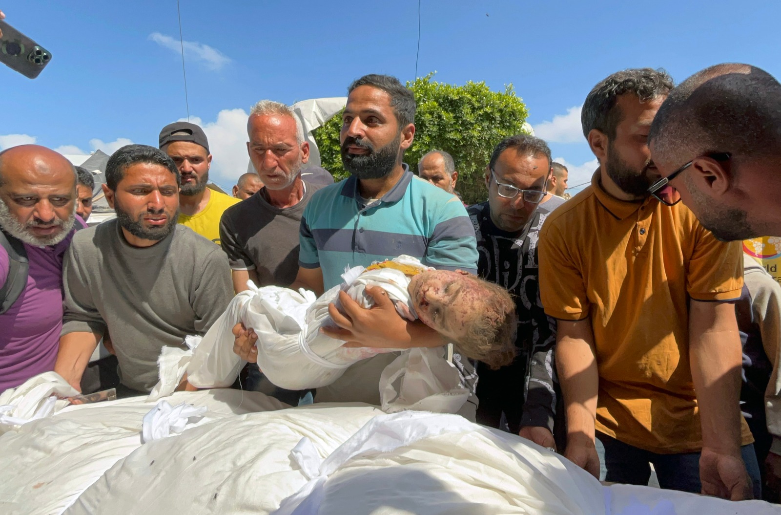 الصحة بغزة: الاحتلال ارتكب 4 مجازر جديدة خلفت 31 شهيداً و56 مصاباً