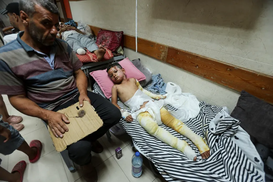 طفل فلسطيني يعاني من حروق مؤلمة بعد غارة على غزة