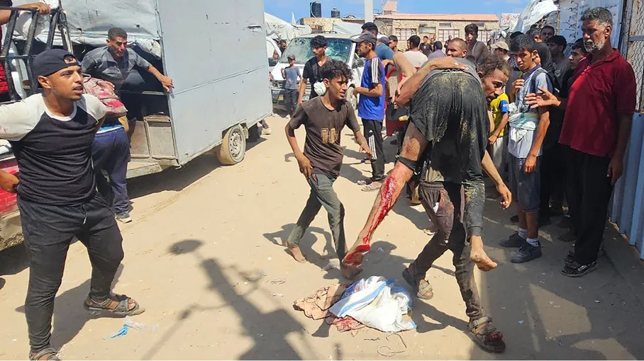 استشهاد 21 مواطنا من منتظري المساعدات بينهم 15 اختناقا بالغاز السام