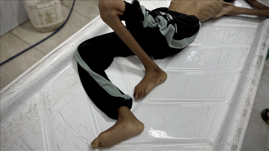 "الأونروا": أهالي غزة يموتون وموظفونا يغمى عليهم من التجويع الشديد