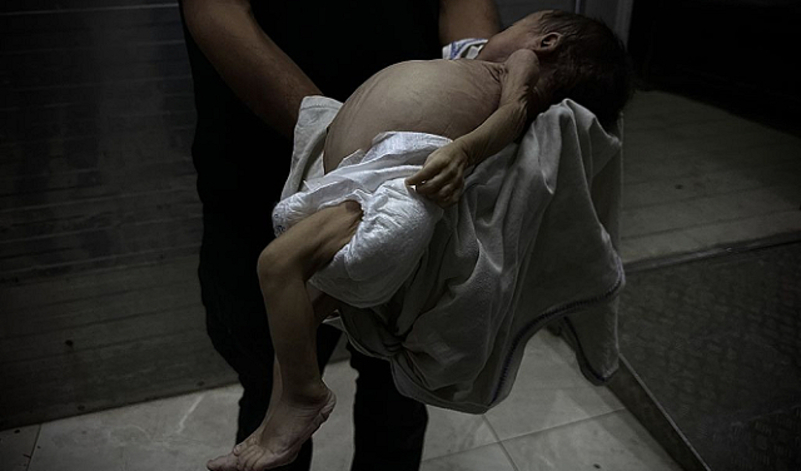 استشهاد الرضيعة راسيل أبو مسعود بسبب التجويع وسوء التغذية