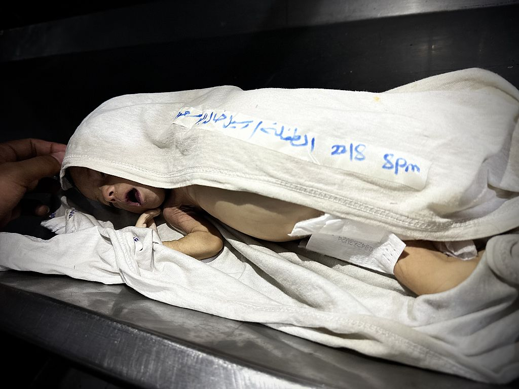 8 وفيات نتيجة المجاعة وسوء التغذية خلال الـ24 ساعة الماضية