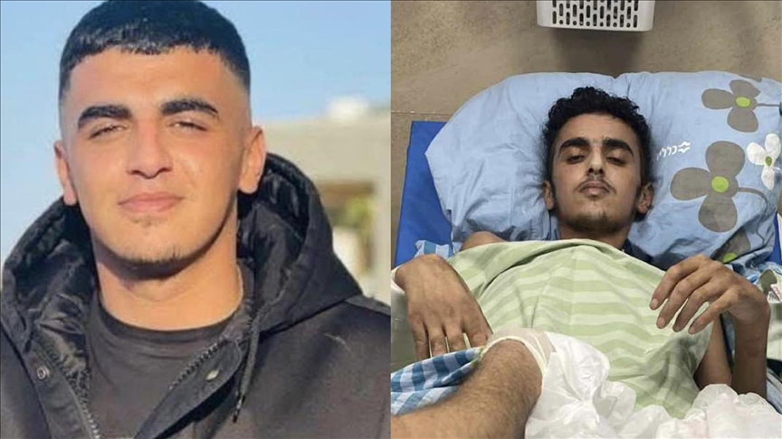 الاحتلال يفرج عن أسير فلسطيني بترت قدمه بعد اعتقاله