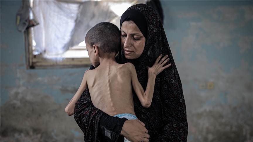 الإعلام الحكومي: 1.2 مليون طفل بالقطاع يعانون انعدام أمن غذائي حاد