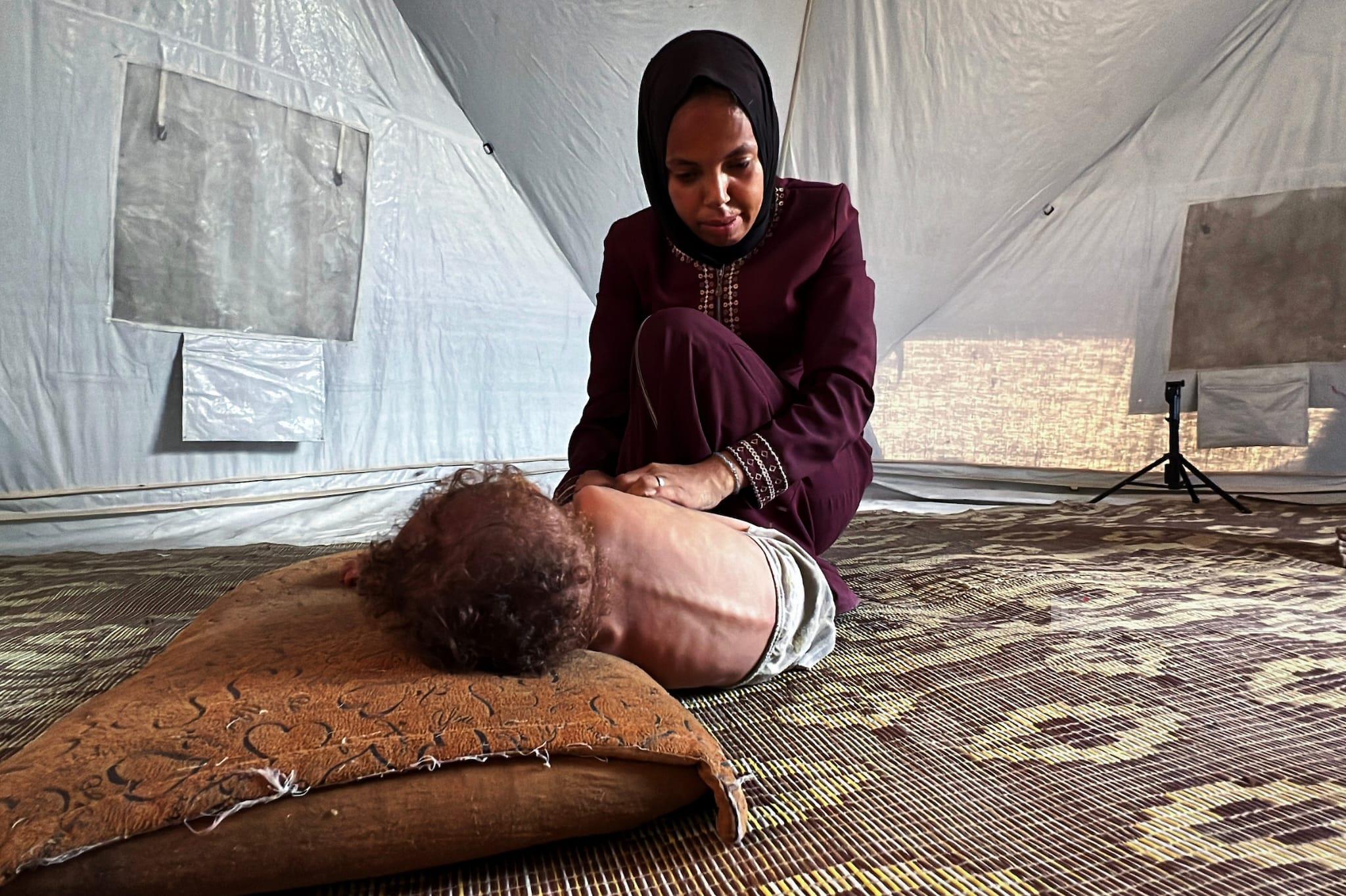 وفاة 4 مواطنين خلال الـ24 ساعة الماضية بسبب سوء التغذية والمجاعة في قطاع غزة