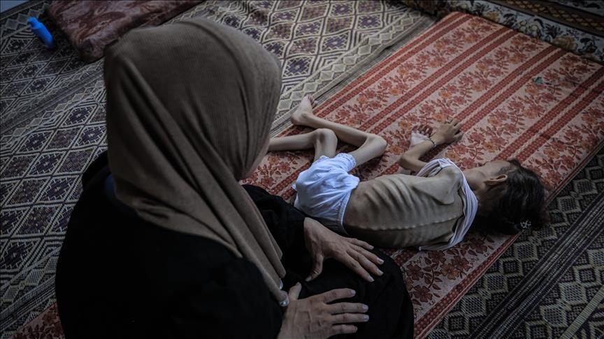 ارتفاع حصيلة شهداء التجويع الإسرائيلي إلى 382 فلسطينيا
